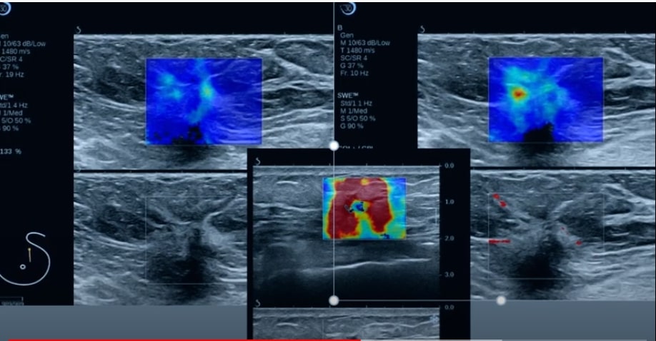 MATHIAS FINK MICKAEL TANTER