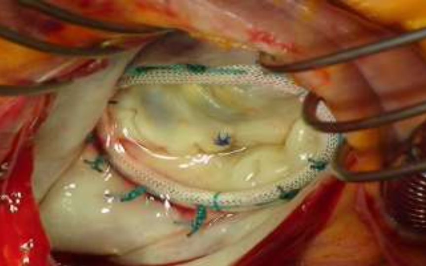 Jean-Philippe Verhoye