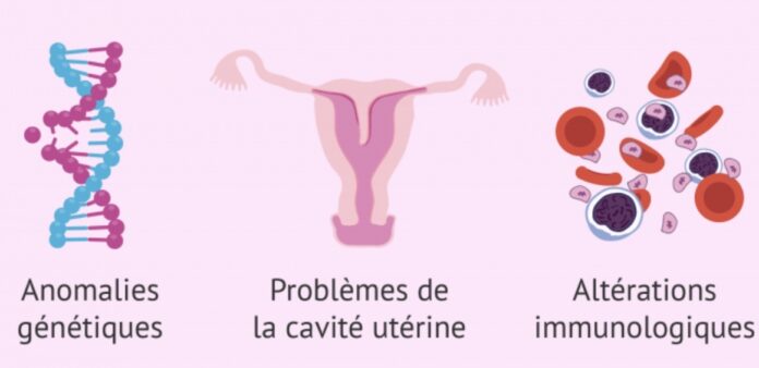 fausse couche fausse couche