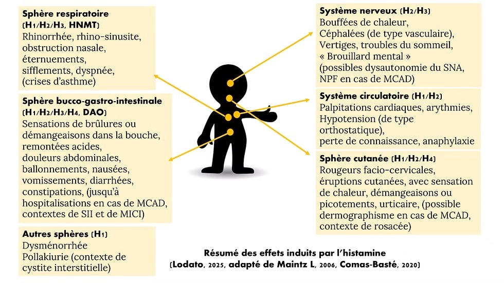 histamine intoxication