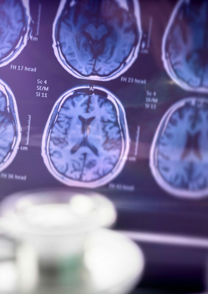 Conférence Alzheimer : est-ce une maladie ? MJC Pacé - Espace Le Goffic Pacé