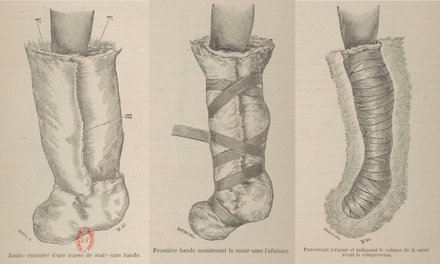 Buste en bronze d’Alphonse Guérin