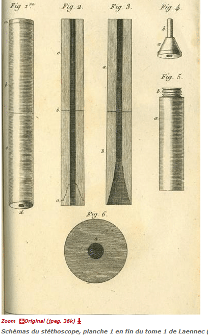 Gravure du XIXe siècle représentant un médecin utilisant un stéthoscope